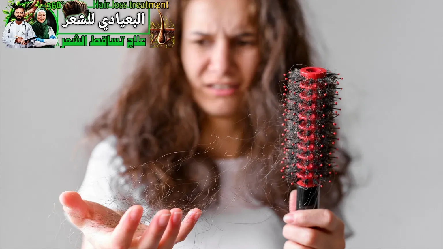 تساقط الشعر الناتج عن حبوب منع الحمل
