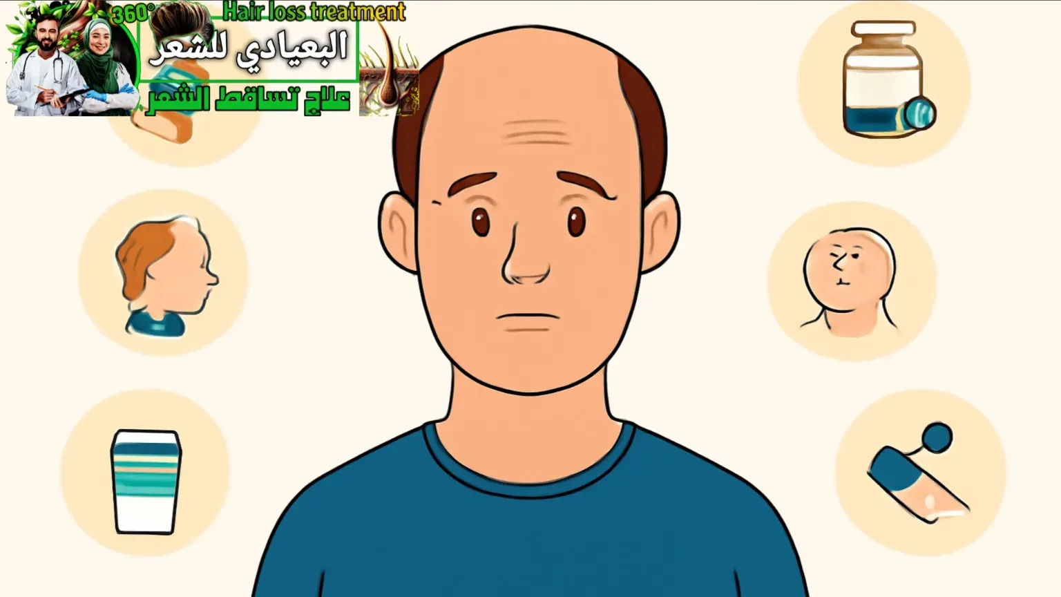 أسباب الصلع عند الرجال